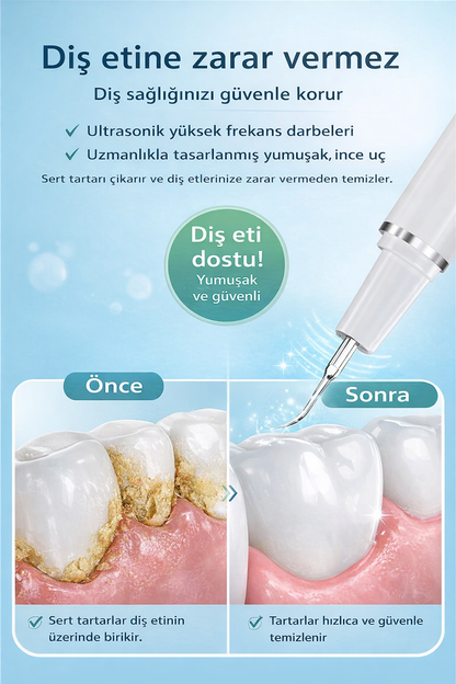 ULTRASONİK ELEKTRİKLİ DİŞ TEMİZLEME SETİ